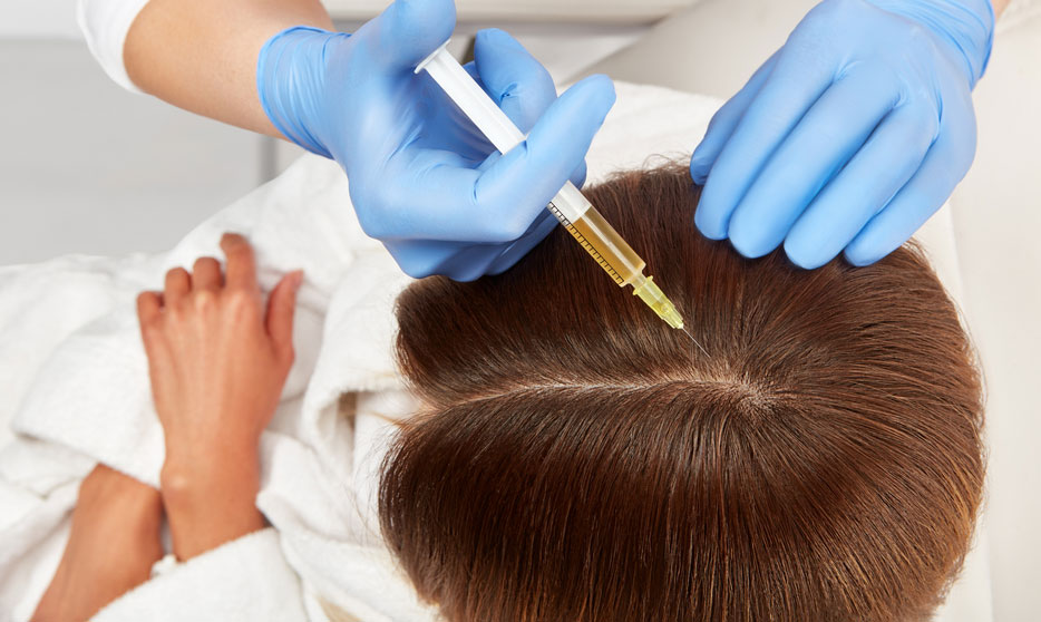 PRP for Hair Restoration