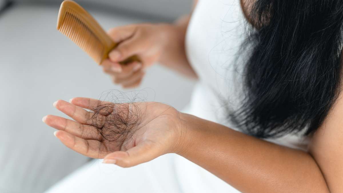 Hair Loss in Women